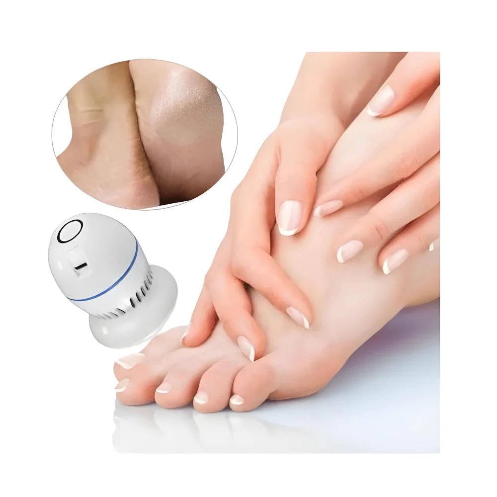 Lixador Elétrico Para Pés PediSoft – Esfoliação e Suavidade Instantânea